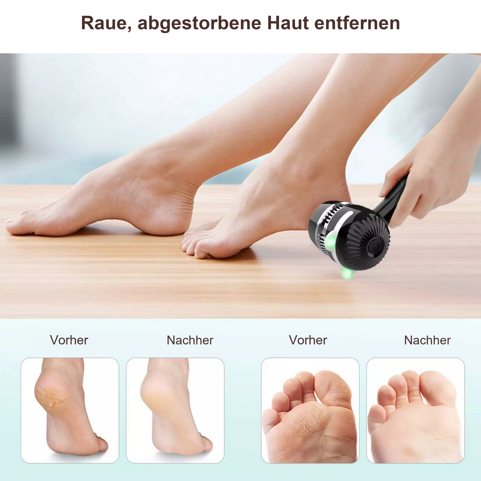 Soft Feet Hornhautentferner – Anwendung an der Ferse mit zwei Vorher-Nachher-Paaren