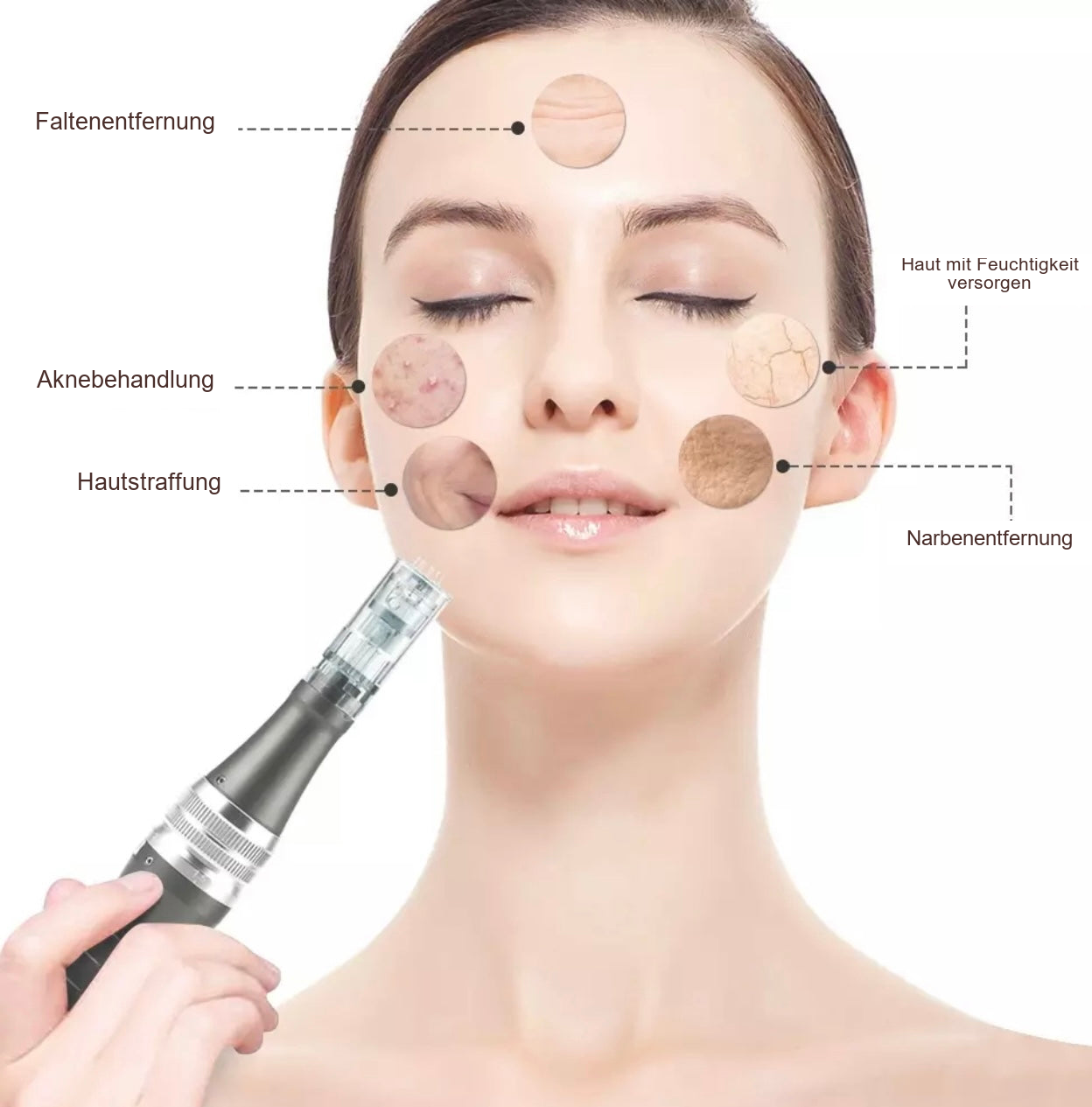 Micro-Needling Doktor Needle Pen, Derma Pen – Gesichtszonen und dargestellte Anwendungsziele