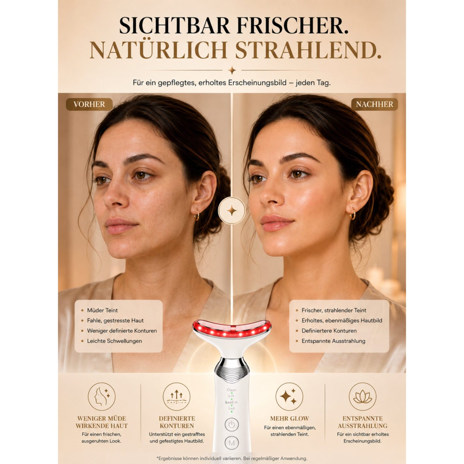 Gesichtsmassagegerät ÉLEVIA Face & Neck Sculptor mit EMS, Wärmefunktion & Vibrationsmassage – vorhandenes Ergebnismotiv